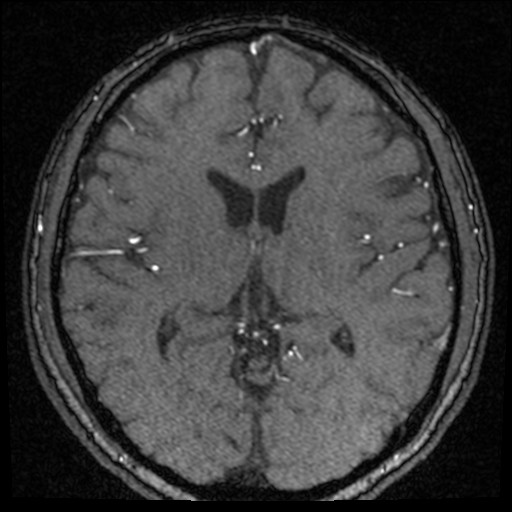 Click on the Serie image to view the images of VILLANUEVA, WILLIAM A.